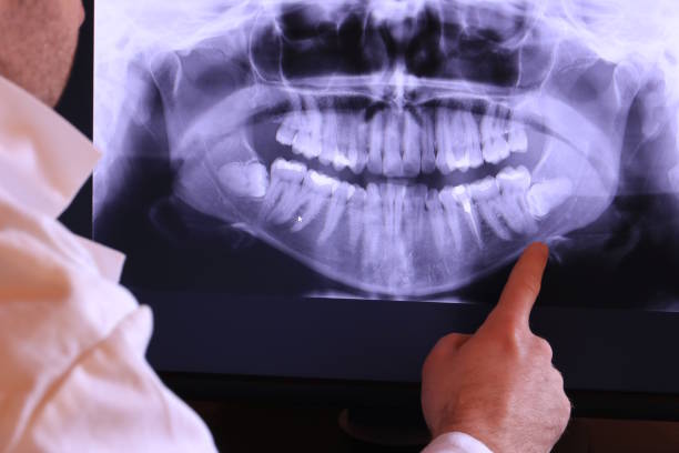 Best Broken or Chipped Tooth Repair in Adairsville, GA