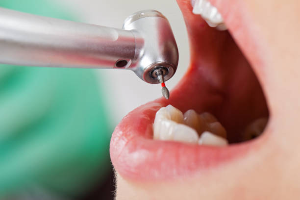 Best Emergency Cosmetic Dentistry (e.g., broken veneers) in Adairsville, GA